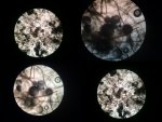 Kf mantar mikroskop grntleri