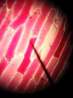 Mikroskopta Bitki Hcresi