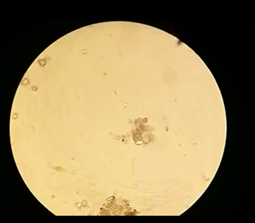 Mikroskobik canllar mikroskopta izledik....