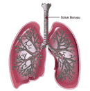 Solunum Sistemin de Bron ve Broncuklar