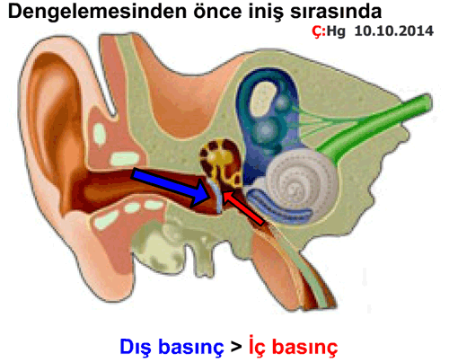 Kulak zarı nasıl çalışır?