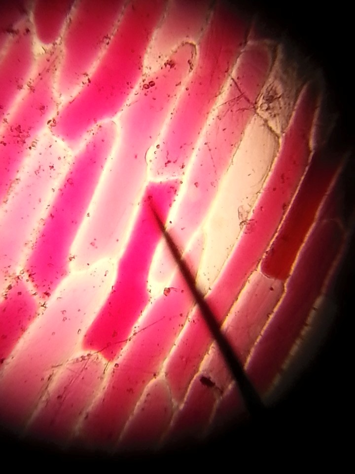 Mikroskopta Bitki Hücresi