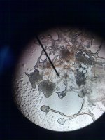 Ekmek kfnn mikroskoptaki gsterimi