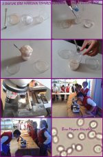 Bira Mayas�n�n tomurcuklanarak �retip mikroskopta g�zlenmesi.