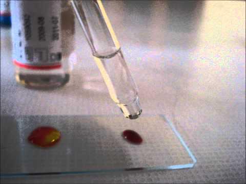 Kan gurubu tespidi nasl yaplr?