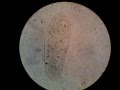 Terliksi Hayvan (Paramecium )  grnts
