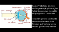 Grme olay