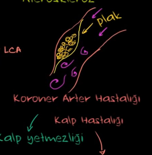 Kalp Hastalklar ve Kalp Krizi ( leri dzey bilgi ierir )